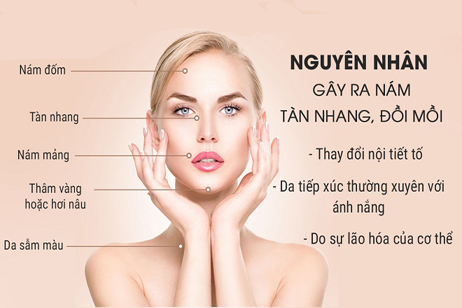 Nguyên nhân dẫn đến nám đốm nâu